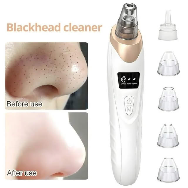 5 in 1 Electric Blackhead Remover Beauty Device