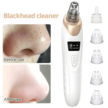 5 in 1 Electric Blackhead Remover Beauty Device