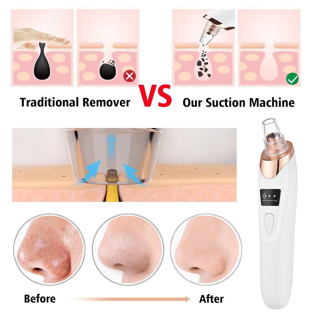 5 in 1 Electric Blackhead Remover Beauty Device