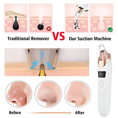 5 in 1 Electric Blackhead Remover Beauty Device