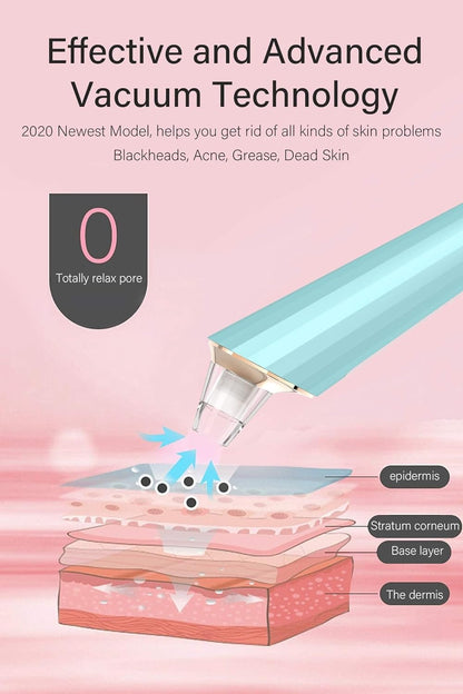 5 in 1 Electric Blackhead Remover Beauty Device