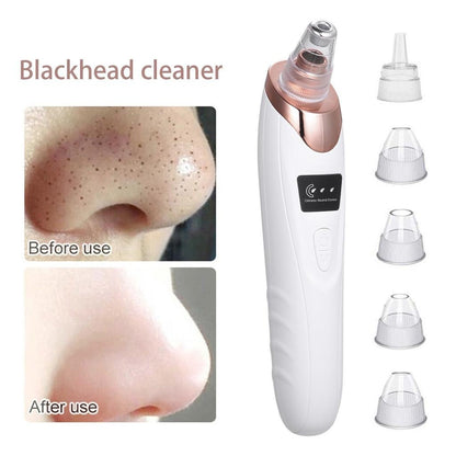 5 in 1 Electric Blackhead Remover Beauty Device