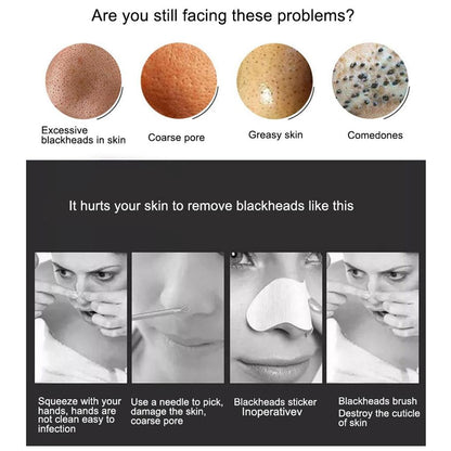 5 in 1 Electric Blackhead Remover Beauty Device